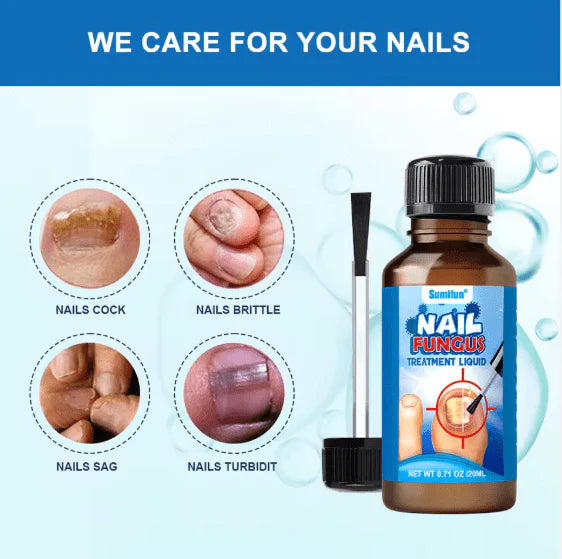 Sumifun Nail Fungus Treatment Liquid – Antifungal Nail Repair Solution 20ml